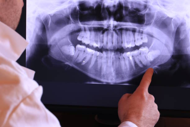 Best Emergency Root Canal Therapy in Robins, IA