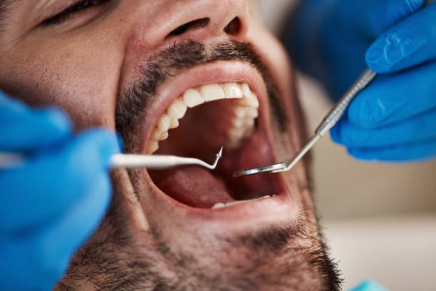 Best Emergency Cosmetic Dentistry (e.g., broken veneers) in Robins, IA